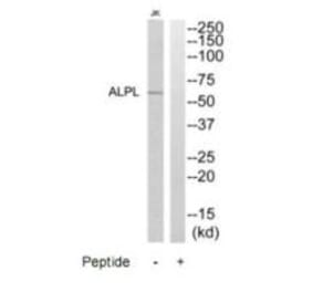 Western blot - ALPL Antibody from Signalway Antibody (35234) - Antibodies.com