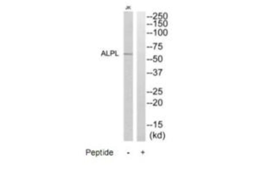 Western blot - ALPL Antibody from Signalway Antibody (35234) - Antibodies.com
