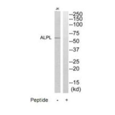 Western blot - ALPL Antibody from Signalway Antibody (35234) - Antibodies.com