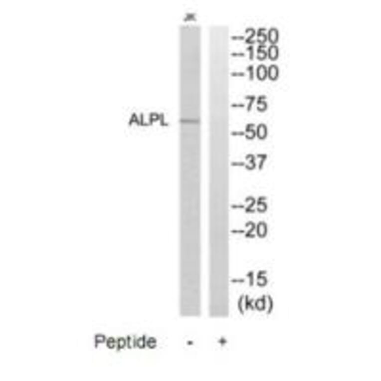 Labil (Labetalol) - Aark Pharmaceuticals