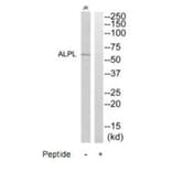 Western blot - ALPL Antibody from Signalway Antibody (35234) - Antibodies.com