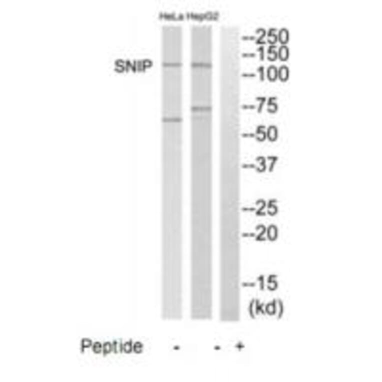 Western blot - SNIP Antibody from Signalway Antibody (35235) - Antibodies.com