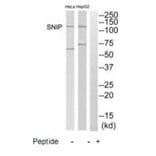 Western blot - SNIP Antibody from Signalway Antibody (35235) - Antibodies.com