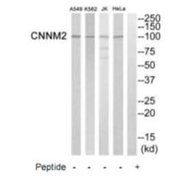 Western blot - CNNM2 Antibody from Signalway Antibody (35245) - Antibodies.com
