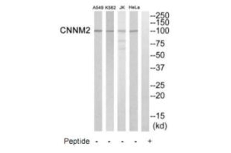 Western blot - CNNM2 Antibody from Signalway Antibody (35245) - Antibodies.com
