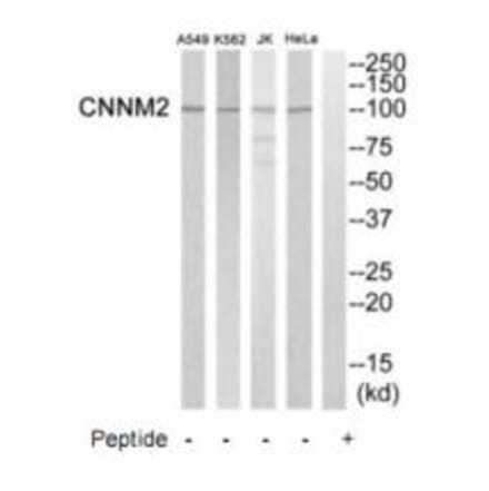 Western blot - CNNM2 Antibody from Signalway Antibody (35245) - Antibodies.com