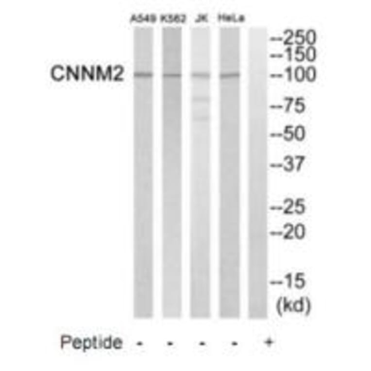 Western blot - CNNM2 Antibody from Signalway Antibody (35245) - Antibodies.com