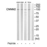 Western blot - CNNM2 Antibody from Signalway Antibody (35245) - Antibodies.com