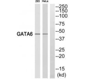 Western blot - GATA6 Antibody from Signalway Antibody (35247) - Antibodies.com