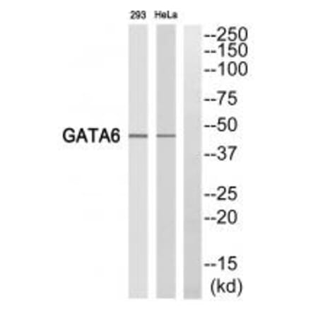 Western blot - GATA6 Antibody from Signalway Antibody (35247) - Antibodies.com
