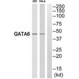 Western blot - GATA6 Antibody from Signalway Antibody (35247) - Antibodies.com