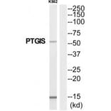 Western blot - PTGIS Antibody from Signalway Antibody (35256) - Antibodies.com