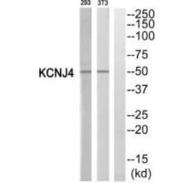 Western blot - KCNJ4 Antibody from Signalway Antibody (35275) - Antibodies.com