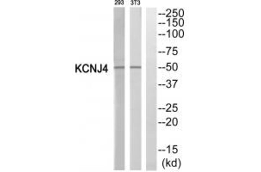 Western blot - KCNJ4 Antibody from Signalway Antibody (35275) - Antibodies.com