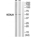 Western blot - KCNJ4 Antibody from Signalway Antibody (35275) - Antibodies.com