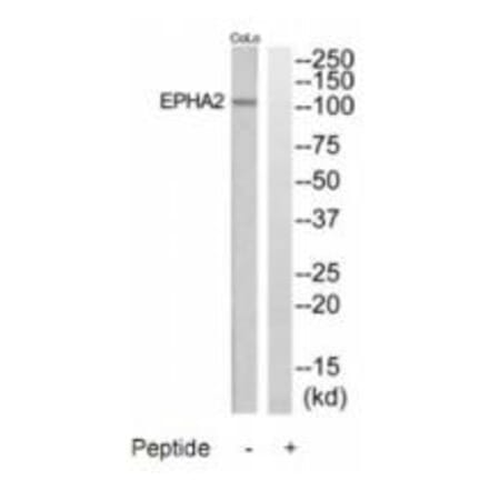 Western blot - EPHA2 Antibody from Signalway Antibody (35284) - Antibodies.com