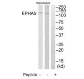 Western blot - EPHA5 Antibody from Signalway Antibody (35285) - Antibodies.com