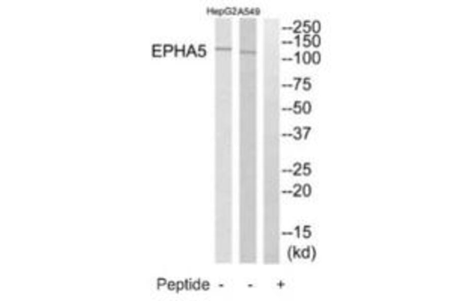 Western blot - EPHA5 Antibody from Signalway Antibody (35285) - Antibodies.com