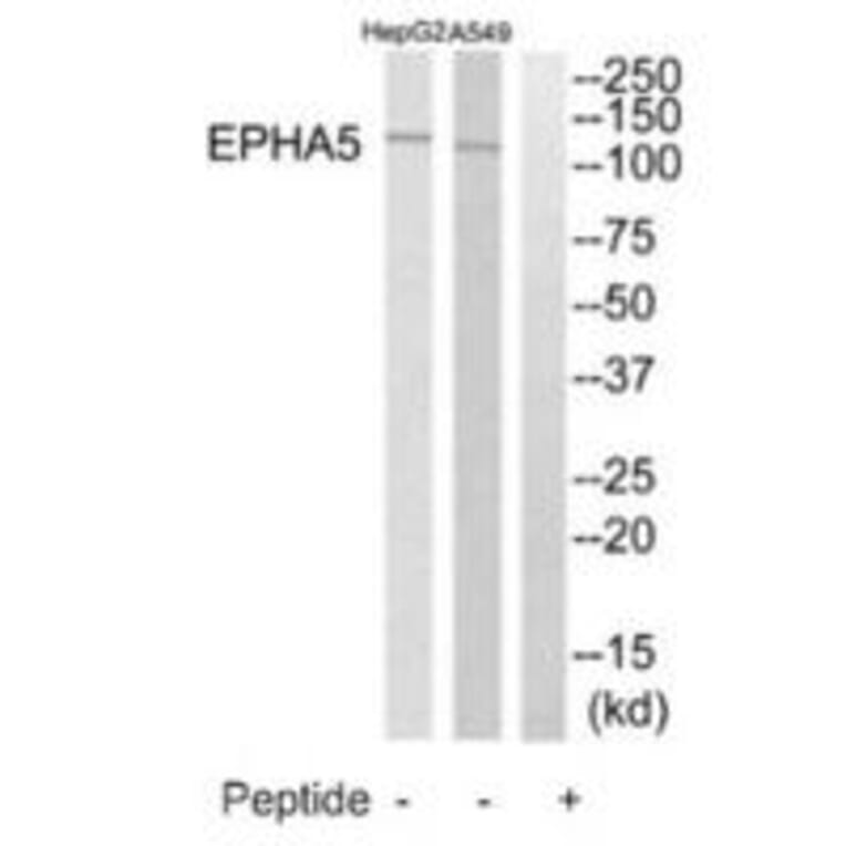 Western blot - EPHA5 Antibody from Signalway Antibody (35285) - Antibodies.com