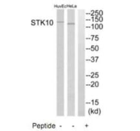 Western blot - STK10 Antibody from Signalway Antibody (35288) - Antibodies.com