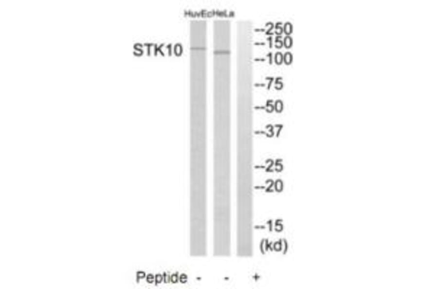Western blot - STK10 Antibody from Signalway Antibody (35288) - Antibodies.com