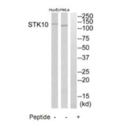 Western blot - STK10 Antibody from Signalway Antibody (35288) - Antibodies.com