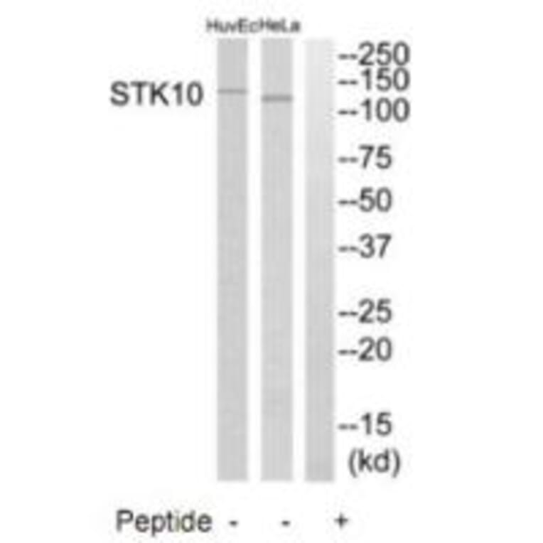 Western blot - STK10 Antibody from Signalway Antibody (35288) - Antibodies.com
