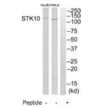 Western blot - STK10 Antibody from Signalway Antibody (35288) - Antibodies.com