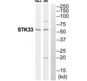 Western blot - STK33 Antibody from Signalway Antibody (35296) - Antibodies.com