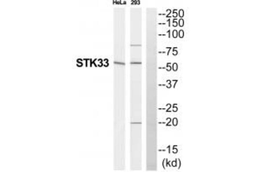 Western blot - STK33 Antibody from Signalway Antibody (35296) - Antibodies.com