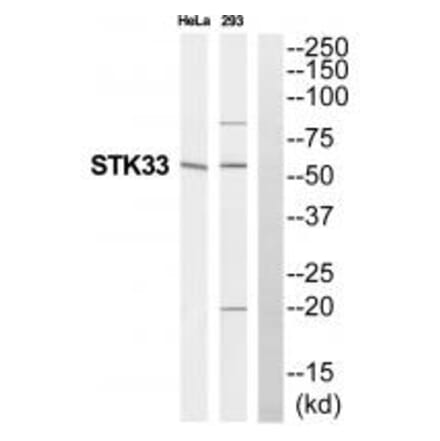 Western blot - STK33 Antibody from Signalway Antibody (35296) - Antibodies.com