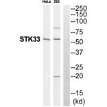 Western blot - STK33 Antibody from Signalway Antibody (35296) - Antibodies.com
