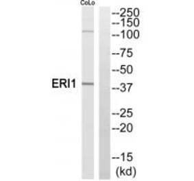 Western blot - ERI1 Antibody from Signalway Antibody (35304) - Antibodies.com