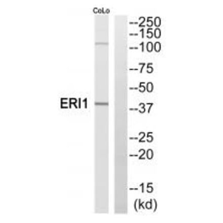 Western blot - ERI1 Antibody from Signalway Antibody (35304) - Antibodies.com