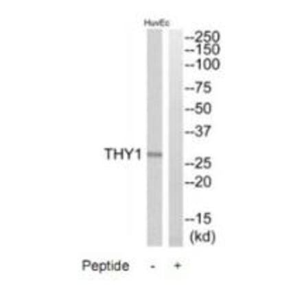 Western blot - THY1 Antibody from Signalway Antibody (35307) - Antibodies.com