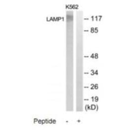 Western blot - LAMP1 Antibody from Signalway Antibody (35308) - Antibodies.com