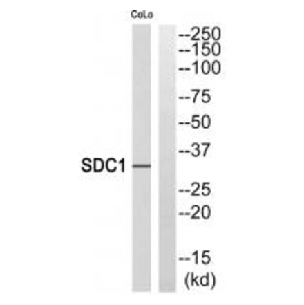 Western blot - SDC1 Antibody from Signalway Antibody (35309) - Antibodies.com