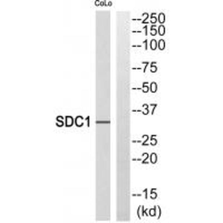 Western blot - SDC1 Antibody from Signalway Antibody (35309) - Antibodies.com