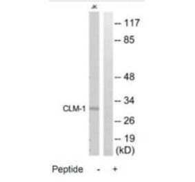 Western blot - CLM-1 Antibody from Signalway Antibody (35314) - Antibodies.com