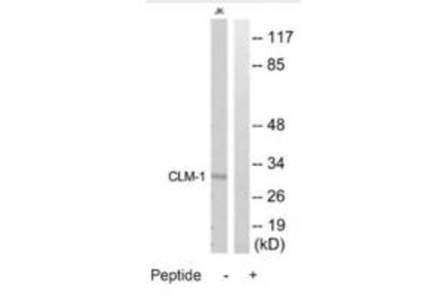 Western blot - CLM-1 Antibody from Signalway Antibody (35314) - Antibodies.com