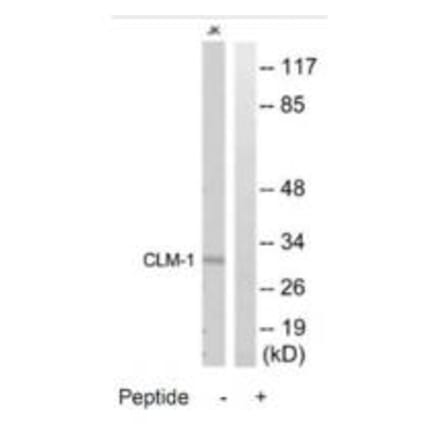 Western blot - CLM-1 Antibody from Signalway Antibody (35314) - Antibodies.com