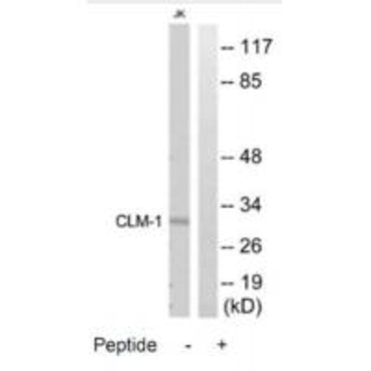 Western blot - CLM-1 Antibody from Signalway Antibody (35314) - Antibodies.com