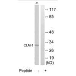 Western blot - CLM-1 Antibody from Signalway Antibody (35314) - Antibodies.com