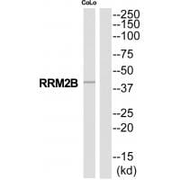 Western blot analysis of extracts from COLO205 cells, using RRM2B antibody #35321.
