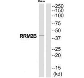 Western blot - RRM2B Antibody from Signalway Antibody (35321) - Antibodies.com