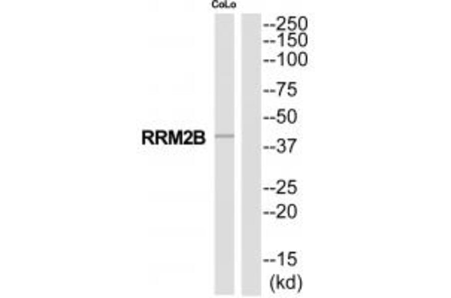 Western blot - RRM2B Antibody from Signalway Antibody (35321) - Antibodies.com