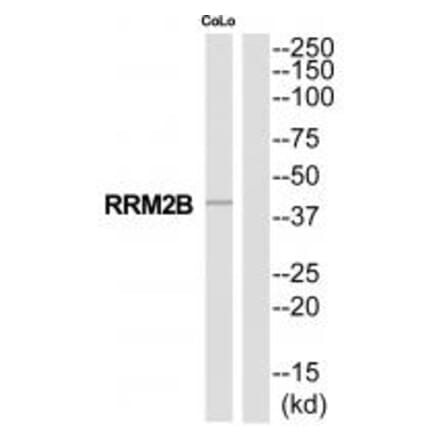 Western blot - RRM2B Antibody from Signalway Antibody (35321) - Antibodies.com