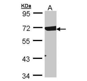 Rad17 Antibody from Signalway Antibody (35336) - Antibodies.com