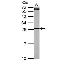 CDC42 Antibody from Signalway Antibody (35353) - Antibodies.com