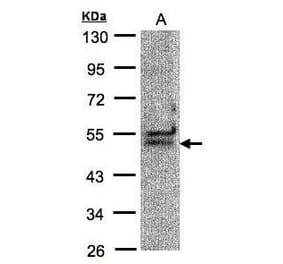 UAP56 Antibody from Signalway Antibody (35371) - Antibodies.com
